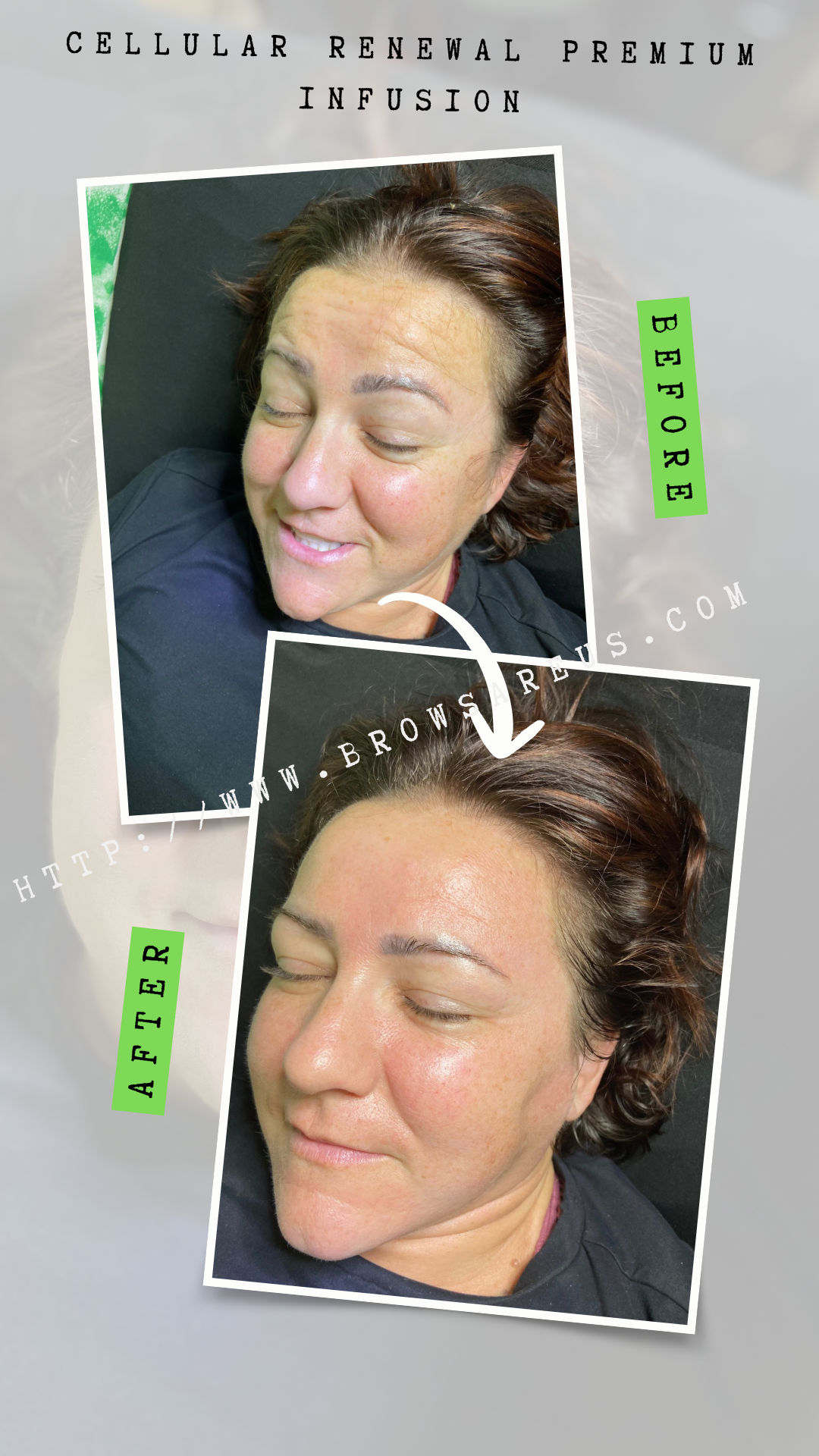 The Best Facial for Long-Lasting Results in Raleigh & Burlington