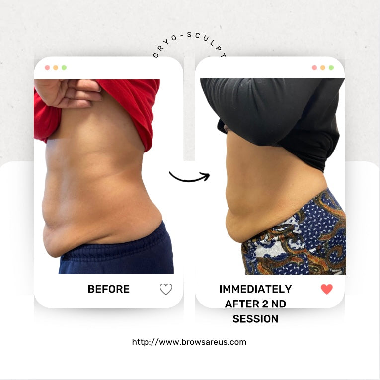 Contour & Sculpt: Advanced Cryo Body Slimming Treatment – Exclusive Raleigh/Triad Offer- Raleigh Burlington, NC