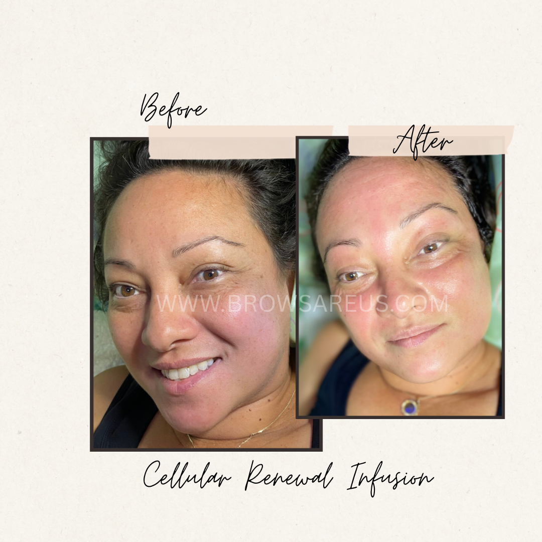 The Cellular Renewal Infusion – Exclusive to Brows Are Us (Raleigh & Burlington, NC)