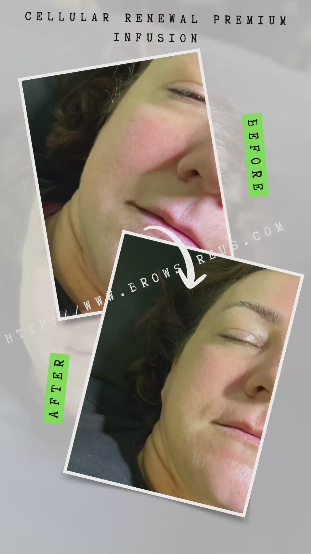 The Cellular Renewal Infusion – Exclusive to Brows Are Us (Raleigh & Burlington, NC)
