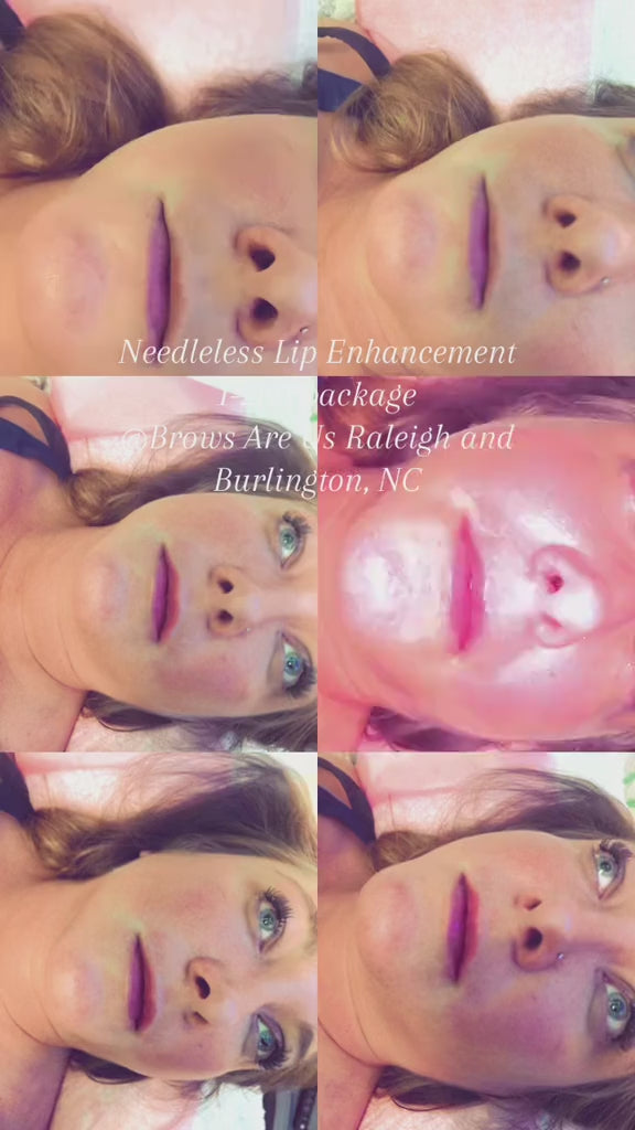 Needleless Lip Enhancement | Brows Are Us — Burlington NC | Raleigh NC