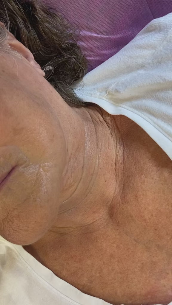 Freeze & Firm: Cryo Slimming Facial for a Sculpted Glow -Raleigh, Burlington NC