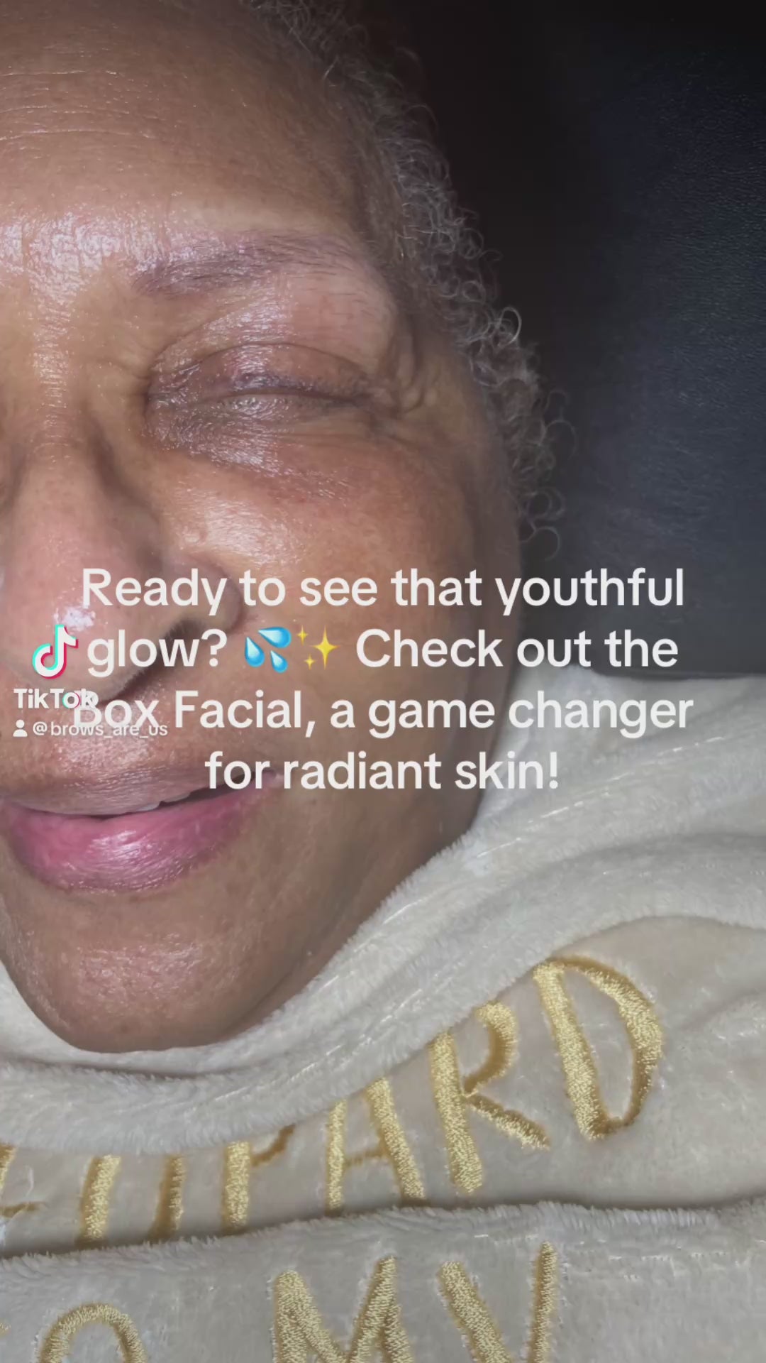 Tox-Infused Microneedling Facial -Raleigh Burlington, NC