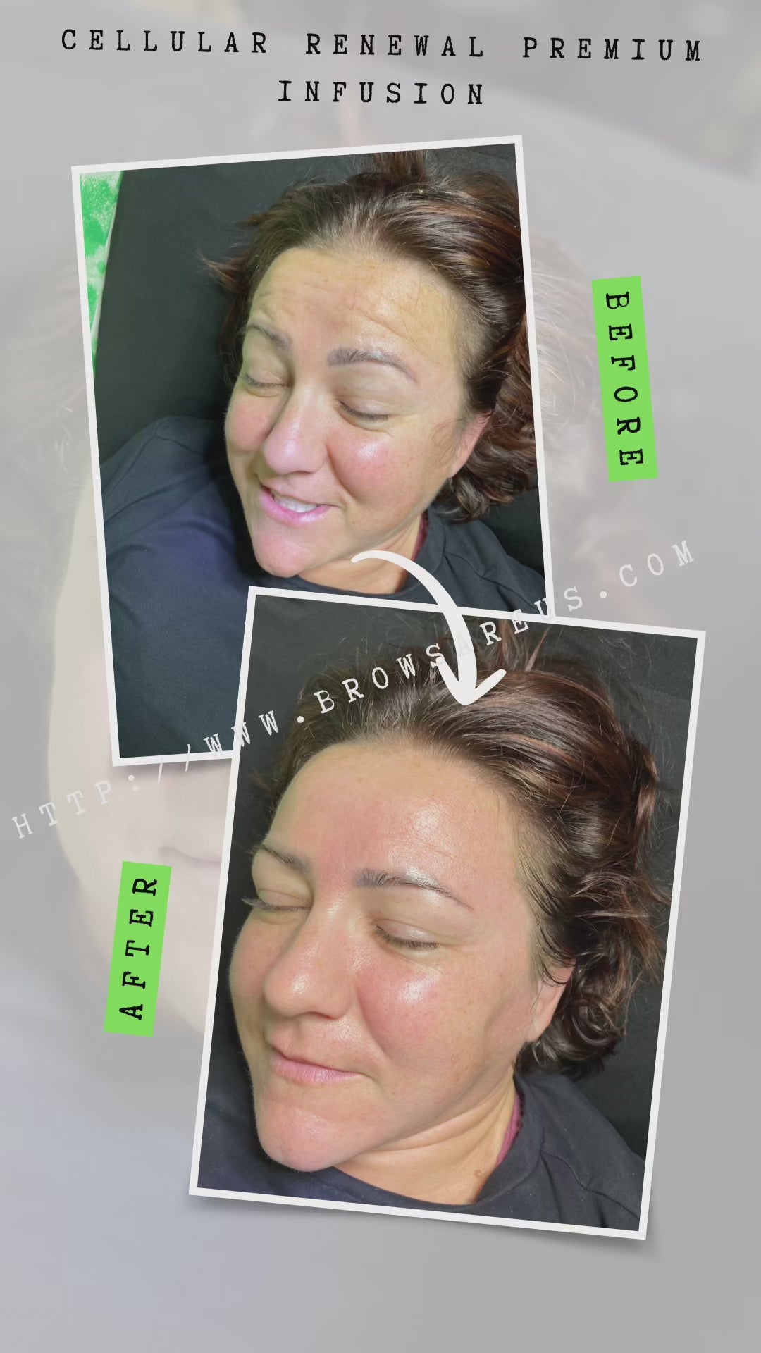 The Cellular Renewal Infusion – Exclusive to Brows Are Us (Raleigh & Burlington, NC)
